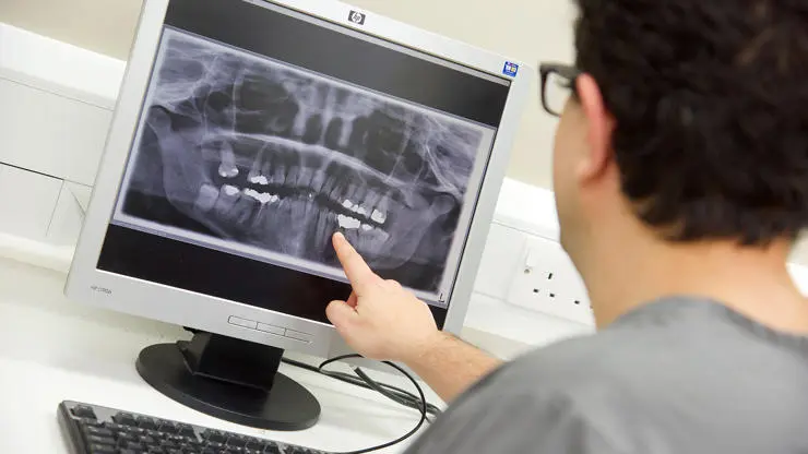 Dental X-ray equipment